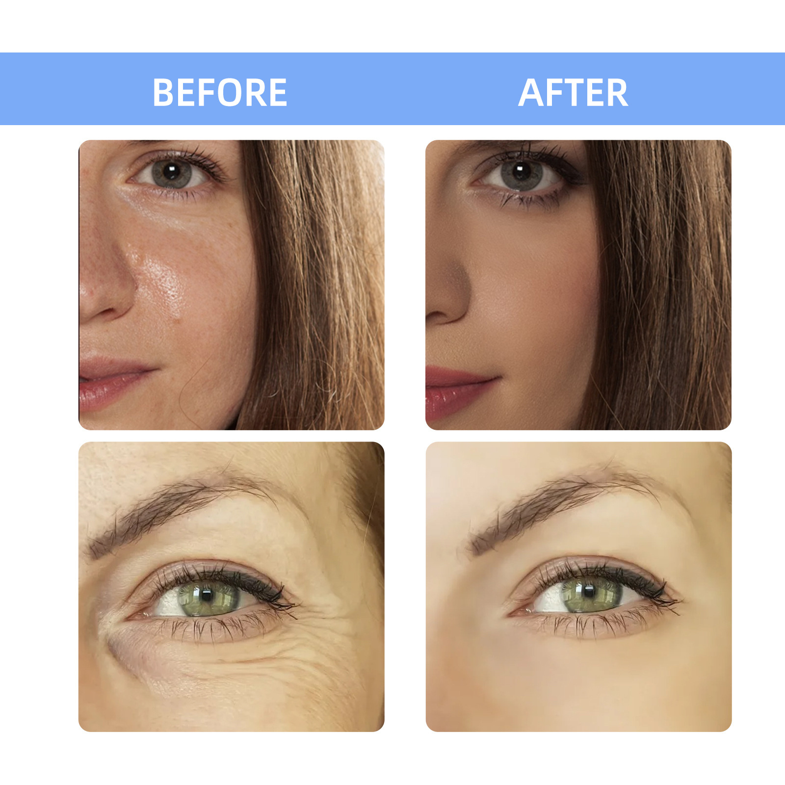 2ml*7pcs 히알루론산 메소 페이스 앰플 세럼 화이 - Hyaluronic Acid Facial Serum 리뷰 및 가격