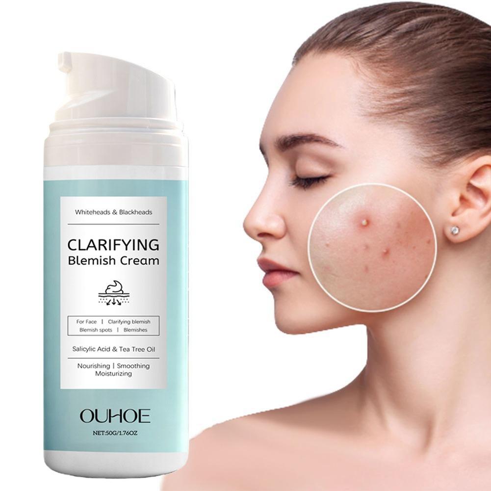 살리실산 여드름 제거 크림 영양 공급 가벼운 무지방 살 - Salicylic Acid Blackhead Remover 리뷰 및 가격
